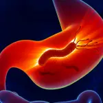 H-Pylori-e1521316035549-660×350
